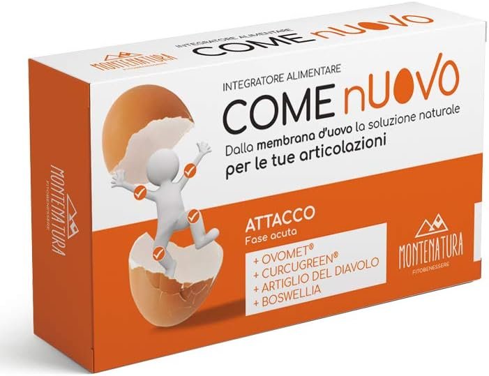 Kit Ring Alarm – S con sirena per esterni | Sistema di allarme per la sicurezza della tua casa con monitoraggio assistito opzionale – Senza vincoli di lunga durata – Compatibile con Alexa